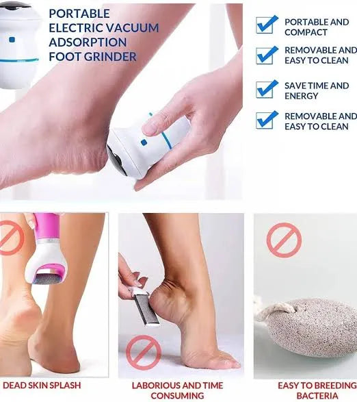 Portable Vacuum Foot Grinder - Electric Callus Remover