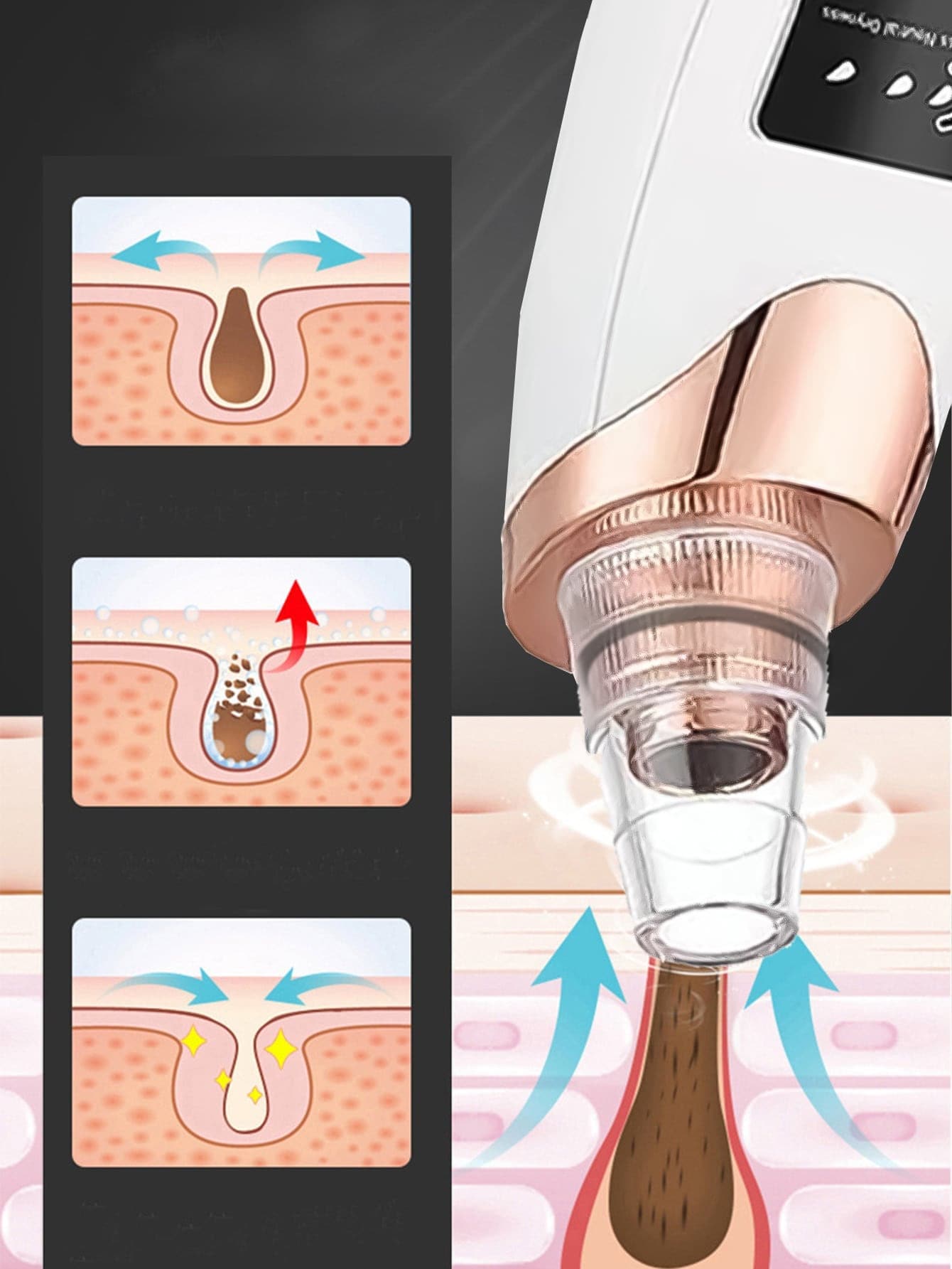 Rechargeable Blackhead / Pore Vacuum Remover
