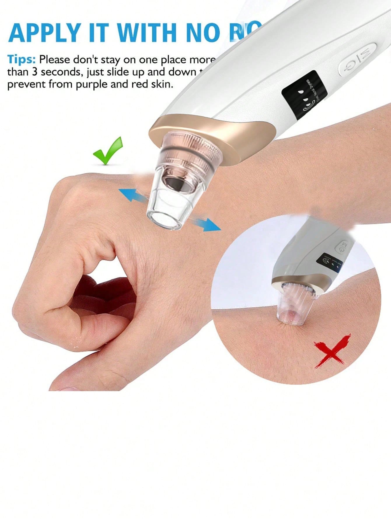 Rechargeable Blackhead / Pore Vacuum Remover