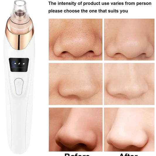 Rechargeable Blackhead / Pore Vacuum Remover